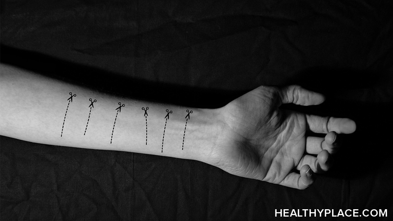 cutting scars on wrist black and white